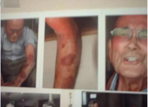 日本核辐射下的变异人