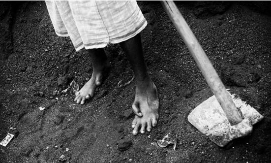 日本核辐射下的变异人