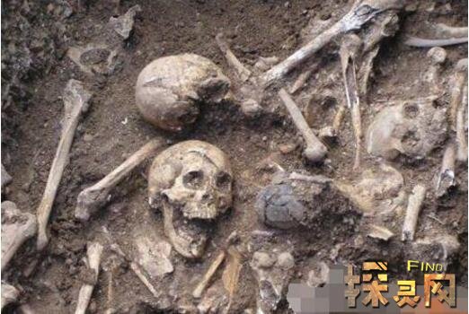 5个真实的僵尸事件